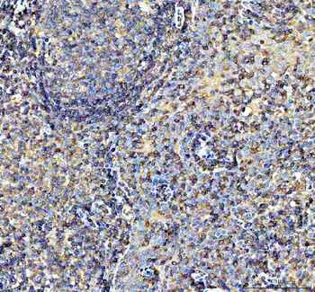 Anti-AIRE Antibody