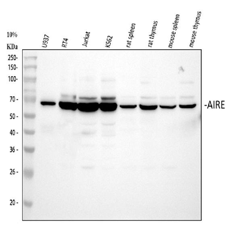 Anti-AIRE Antibody