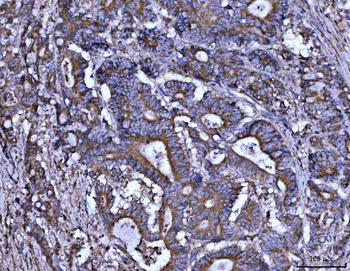 Anti-ALDH1A2 Antibody