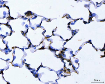 Anti-ALDH1A2 Antibody