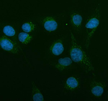 Anti-AMACR Antibody
