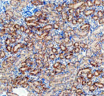 Anti-AMACR Antibody