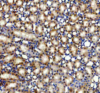 Anti-AMACR Antibody