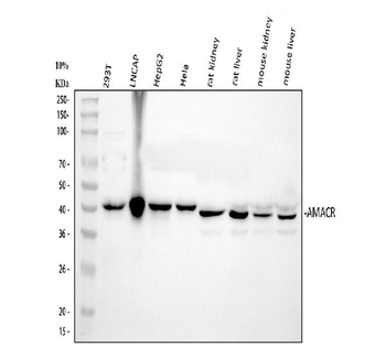 Anti-AMACR Antibody