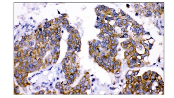 Anti-AMHR2 Antibody