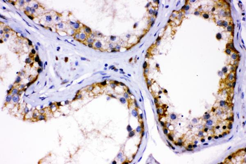 Anti-AMHR2 Antibody