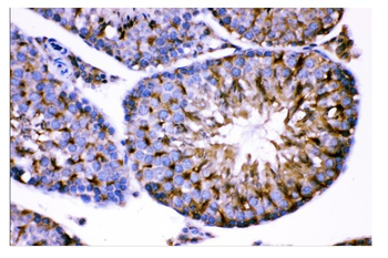 Anti-AMHR2 Antibody