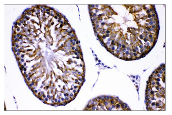Anti-AMHR2 Antibody
