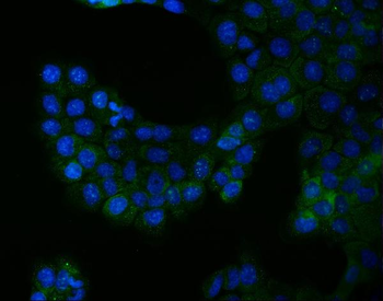 Bcr Rabbit Polyclonal Antibody
