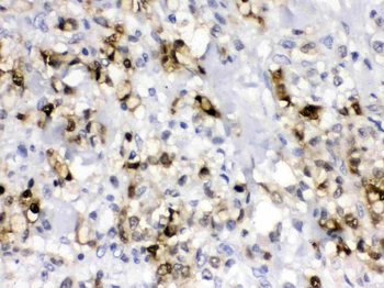 Anti-Carbonic Anhydrase II/CA2 Antibody