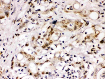 Anti-Cyclin T1/CCNT1 Antibody