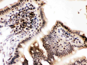 Anti-Cyclin T1/CCNT1 Antibody