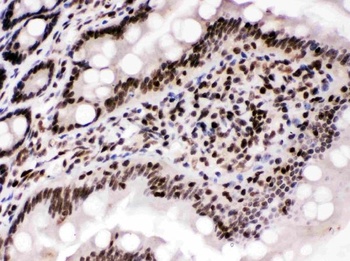 Cyclin T1/CCNT1 Antibody