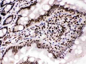 Anti-Cyclin T1/CCNT1 Antibody
