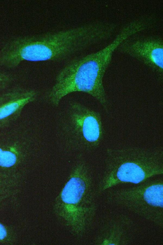 Anti-TCP1 beta/CCT2 Antibody