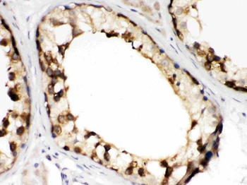 Anti-TCP1 beta/CCT2 Antibody