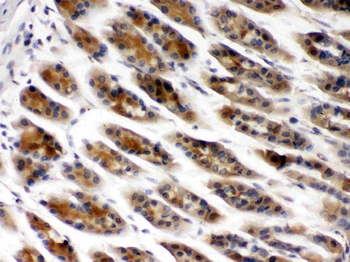 Anti-TCP1 beta/CCT2 Antibody
