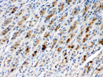 Anti-TCP1 beta/CCT2 Antibody