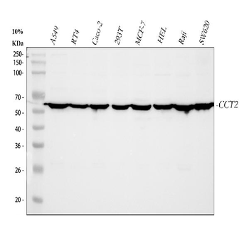 Anti-TCP1 beta/CCT2 Antibody