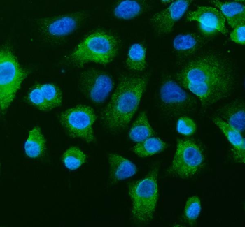 Anti-TCP1 theta/CCT8 Antibody