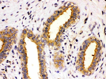 Anti-TCP1 theta/CCT8 Antibody
