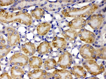 Anti-TCP1 theta/CCT8 Antibody