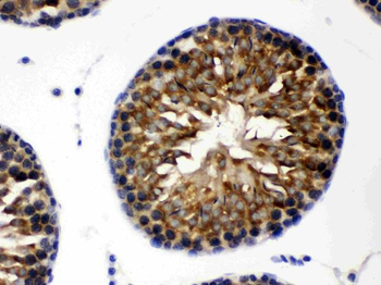 Anti-TCP1 theta/CCT8 Antibody