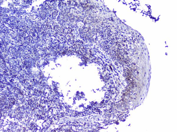 Anti-Cdk6 Antibody