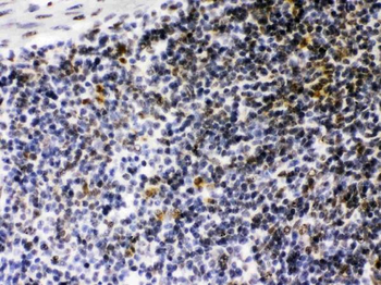 Anti-CIITA Antibody