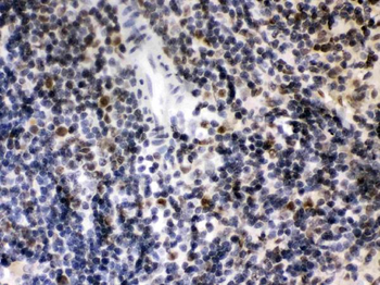 Anti-CIITA Antibody