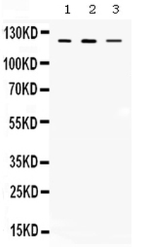 Anti-CIITA Antibody