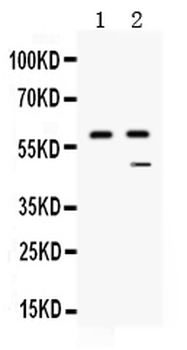 Carboxypeptidase B2/CPB2 Antibody