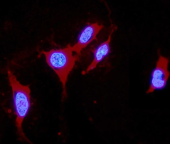 Anti-DDAH1 Antibody