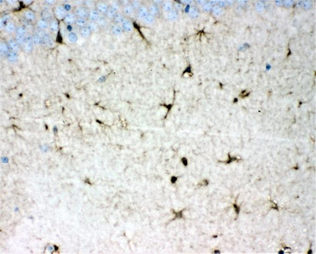 Anti-DDAH1 Antibody