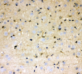 Anti-DDAH1 Antibody