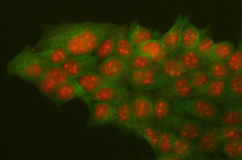 Anti-HMGB2 Antibody