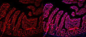Anti-HMGB2 Antibody