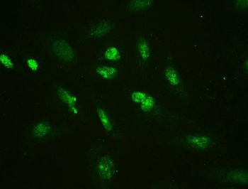 Anti-HMGB2 Antibody