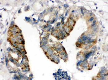 Anti-HMGB2 Antibody