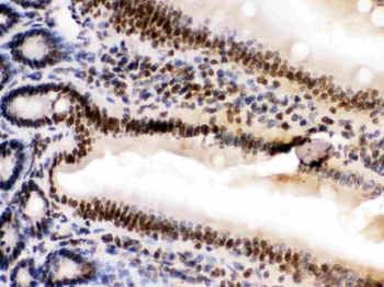 Anti-HMGB2 Antibody
