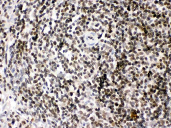 Anti-HMGB2 Antibody