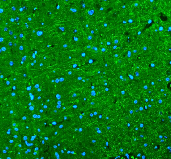 Anti-Alpha Internexin/INA Antibody