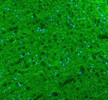 Anti-Alpha Internexin/INA Antibody