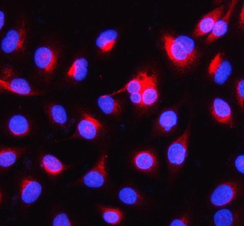Anti-Alpha Internexin/INA Antibody