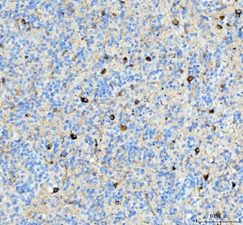 Anti-Alpha Internexin/INA Antibody