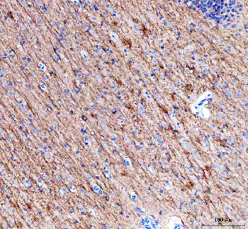 Anti-Alpha Internexin/INA Antibody