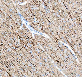 Anti-Alpha Internexin/INA Antibody