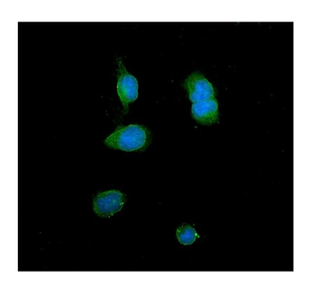 Anti-ITLN1 Antibody