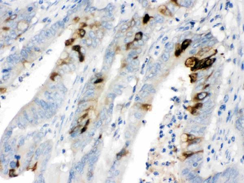 Anti-ITLN1 Antibody