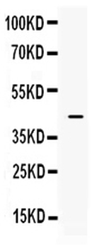 Anti-ITLN1 Antibody